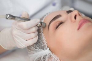 Woman getting microdermabrasion at the spa